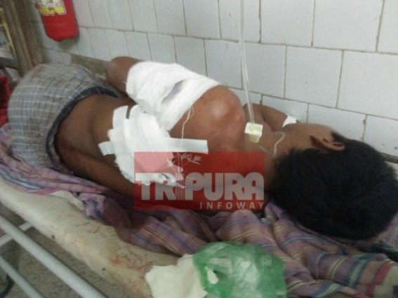 Man shot at Tripura, critical Man shot at Tripura, critical
